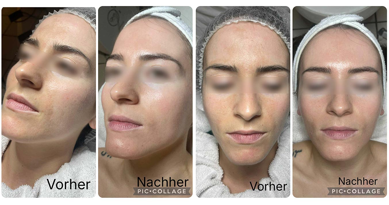 Behandlungen-cosmelan Behandlungen-cosmelan